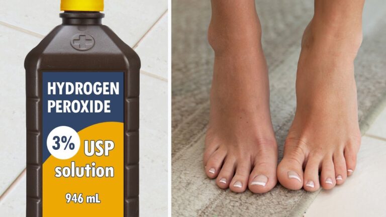 You won’t believe what happens when you put hydrogen peroxide on your feet…