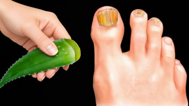 You won’t believe… aloe beats fungus faster than anything else!